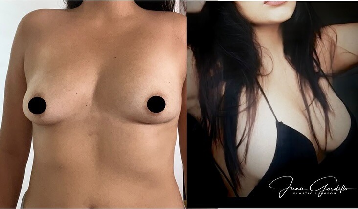 Before and After Result